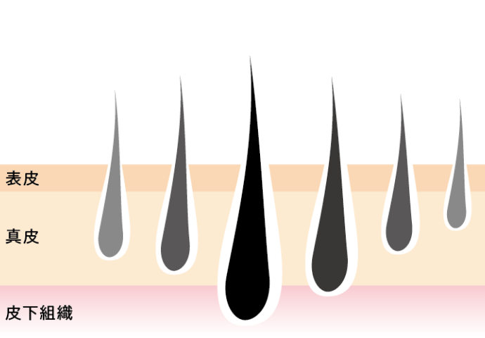 人の毛根は箇所によってそれぞれ深さが違うもの。最短でムダ毛処理をするためには毛根に適したレーザーや光を照射することが大切。